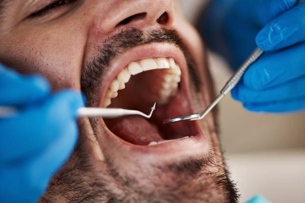 Best Root Canal Emergency Dentist  in Mullens, WV